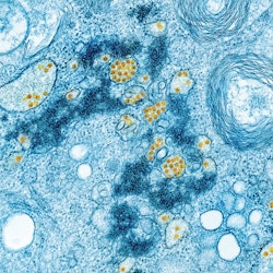 Managing Mold Risk and Microbial Growth in Water Claims