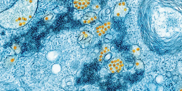 Managing Mold Risk and Microbial Growth in Water Claims