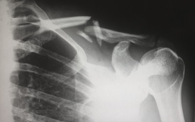 Unveiling New Insights into Workers’ Compensation Patient Care - Insurance Claims News Article