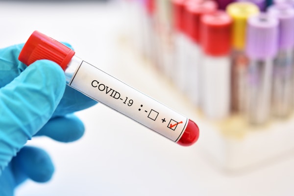 When Is Coronavirus Covered By Workers Comp? How To Tell When Youve Got A Claim On Your Hands