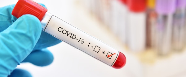 When Is Coronavirus Covered By Workers’ Comp? How To Tell When You’ve Got A Claim On Your Hands (Risk & Insurance)