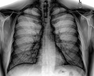 Allegheny Health Network Sues Insurer for COVID-19 Losses - Insurance Claims News Article